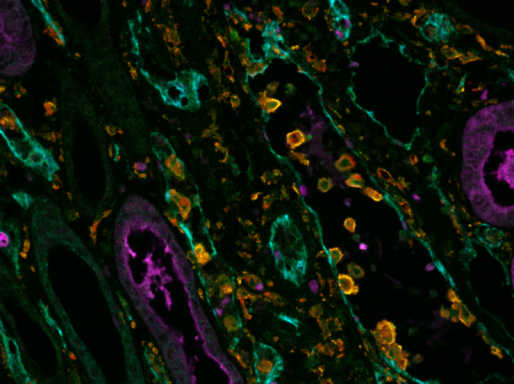 The image shows a 5 colour fluorescence image of kidney and how some cells like macrophages are labelled with multiple colours.