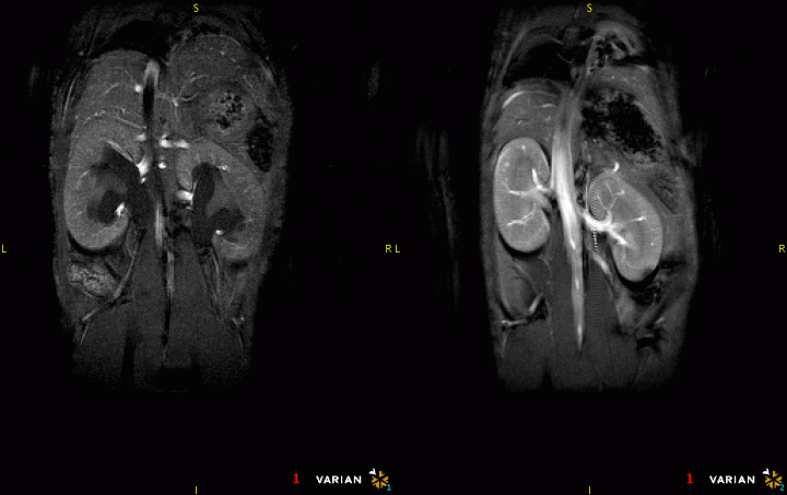 two images of the kidney