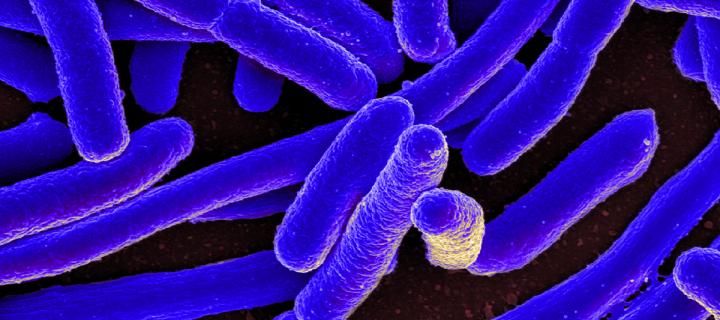Sacnning EM E. coli bacteria