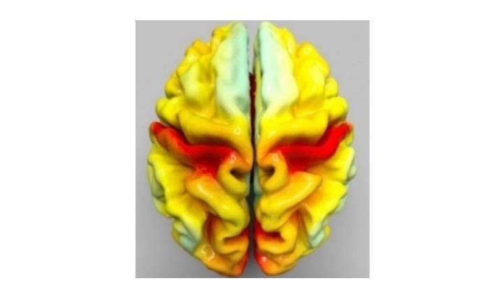 Image of the brain based on hundreds of MRI scans of LBC participants. The colour indicates the average cortical thickness (thin