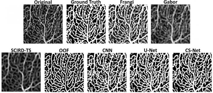A comparison of different vessel enhancement methods on Optical Coherence Tomography Angiography retinal images (Frangi, Gabor, SCIRD-TS, OOF, CNN, U-Net, CS-Net). Ground truth data with manually segmented images were used to assess performances of the different approaches.