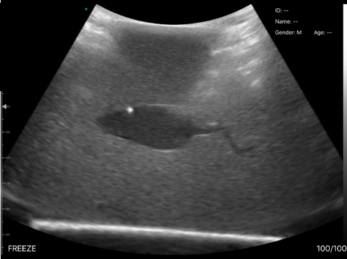 Ultrasound image of the object embedded in gel.