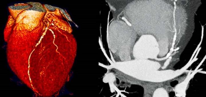 Reconstructed and cross-sectional cardiac CT images.