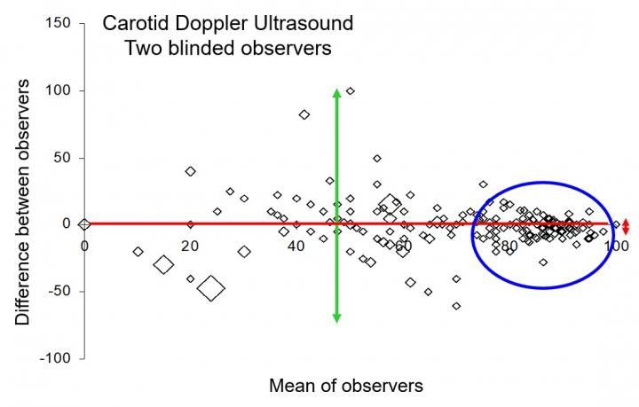 Bland Altman plot in relation to Carotid stenosis imaged using Doppler Ultrasound.