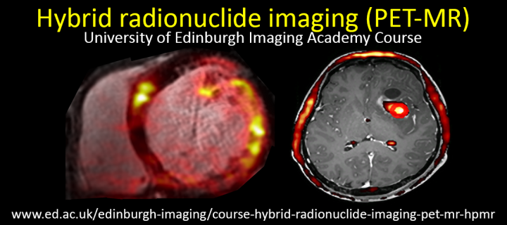 Hybrid radionuclide imaging (PET-MR)