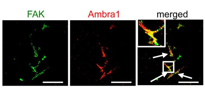 Colocalization of Ambra1 and FAK at cell adhesion sites. Scale bars 20µm