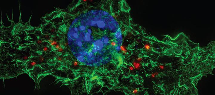 Macrophage Taken with structured illumination microscope