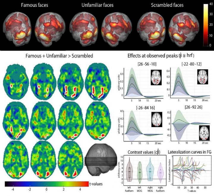fMRI illustration of activations for faces 