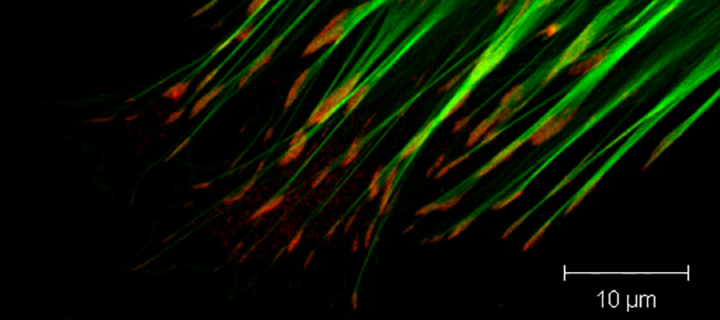Picture showing focal adhesions and actin cytoskeleton in a cell