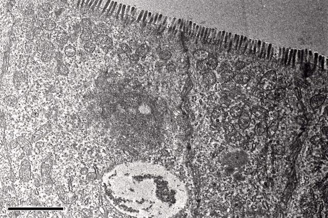 Image of gut cells in inflammatory bowel disease
