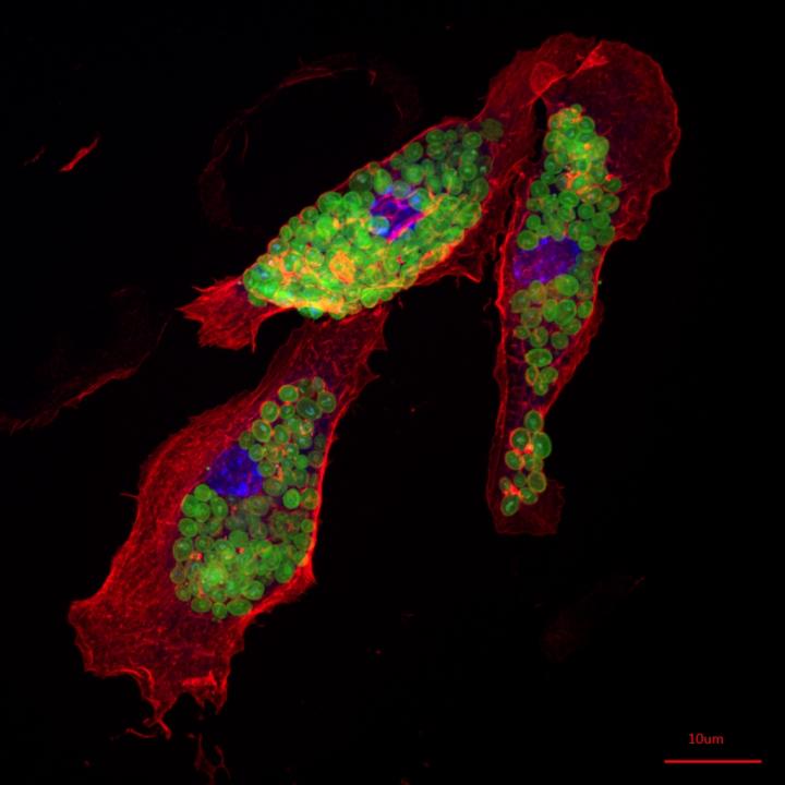 Confocal image of macrophages phagocytosing FITC-labelled zymosan (yeast)