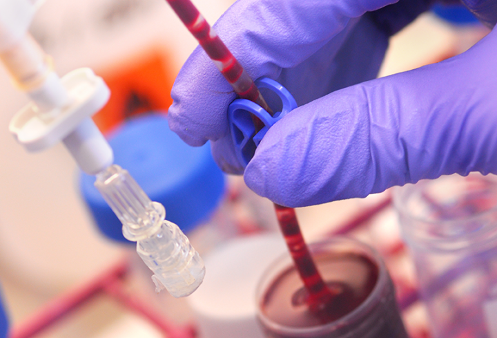 Photograph showing a researcher analysing blood sample in the lab