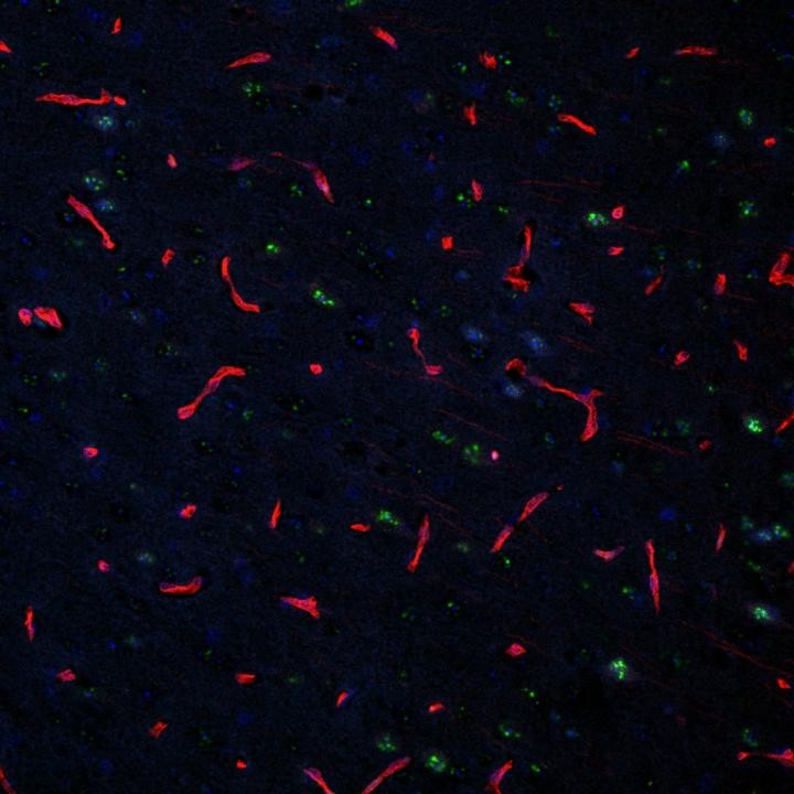 Double label immunofluorecence image of endothelial cells (CD31, red) and UBXN1 (green) to determine if endothelial cells, in a mouse model of small vessel disease, undergo endoplasmic reticulum (ER) stress