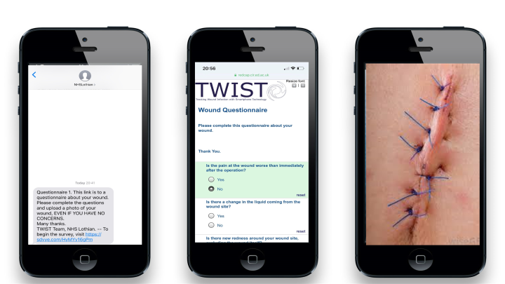 Smartphones displaying app for tracking wound healing