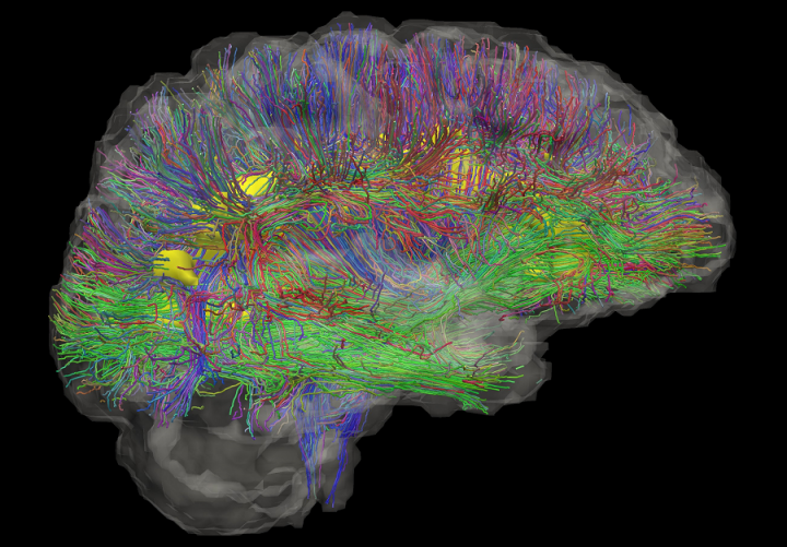 Tractography map of the brain’s white matter using diffusion MRI