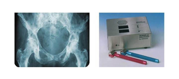pelvic xray and temperature sensibility equipment 
