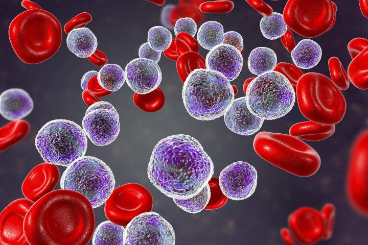 A 3D computer generated image of acute lymphoblastic leukemia with red blood cells