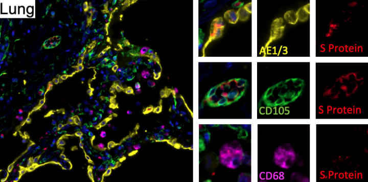 Images showing viral presence inside lung tissue using fluorescent dyes.