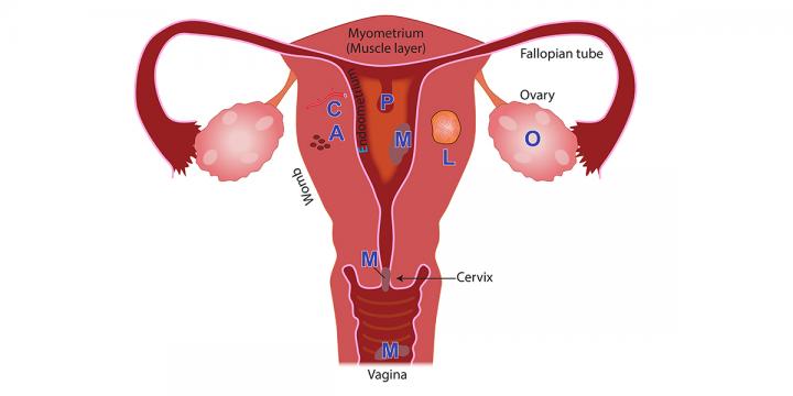 Menstrual-Disorders-Image-11-Mar-2020