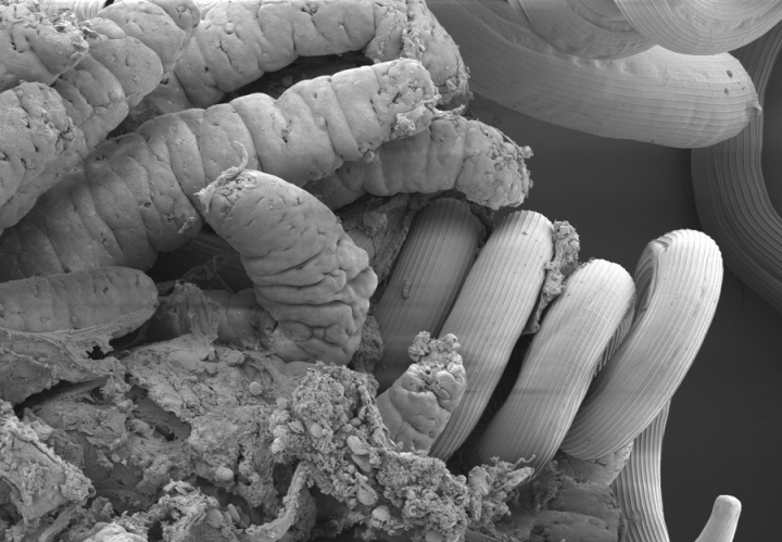 Nematodes inside the mouse intestine
