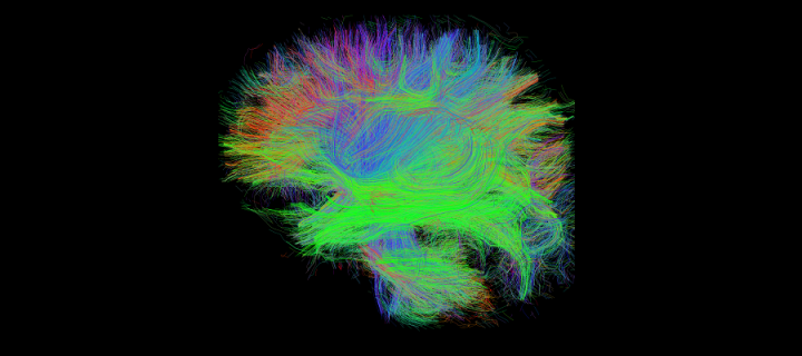 Baby brain pathways. Pathways in the baby brain identified by diffusion magnetic resonance imaging of a sleeping newborn.