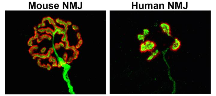 Mouse NMJ compared to Human NMJ