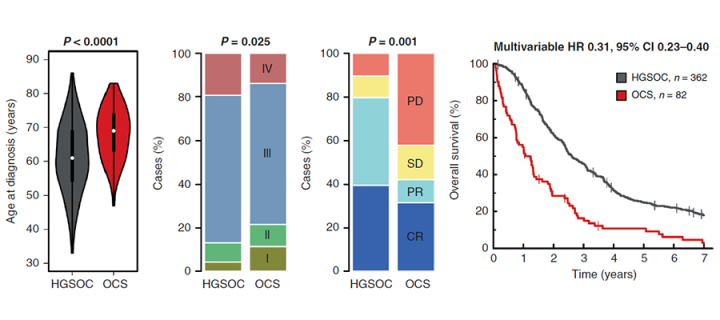 Comparison of ovarian carcinosarcoma (OCS) and high-grade serous ovarian carcinoma (HGSOC).