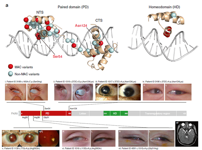 Images of eyes from PAX6 mutations and corresponding position of mutations on PAX6 protein