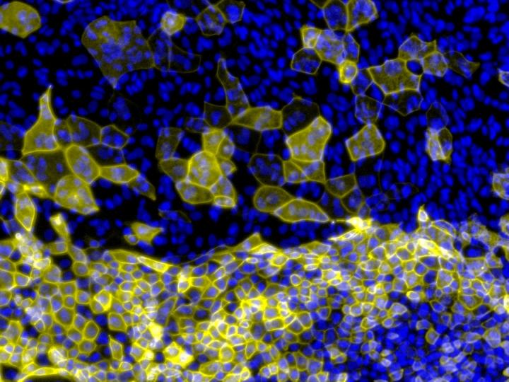Pluripotent cells differentiating into epidermal cells (yellow) in a dish