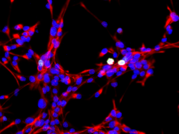 Neural stem cells expanding