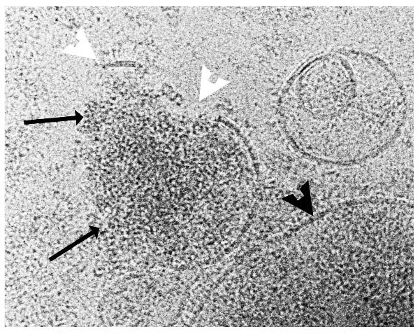 Electron micrograph showing LL-37 mediated disruption of RSV particles