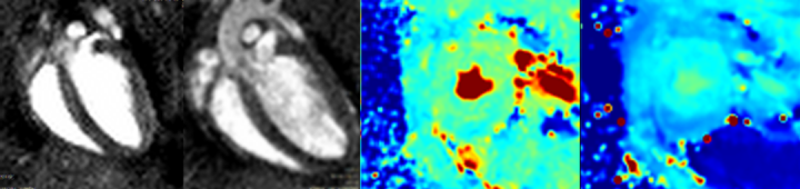 Combined image of four cardiac MRI photos of mouse hearts