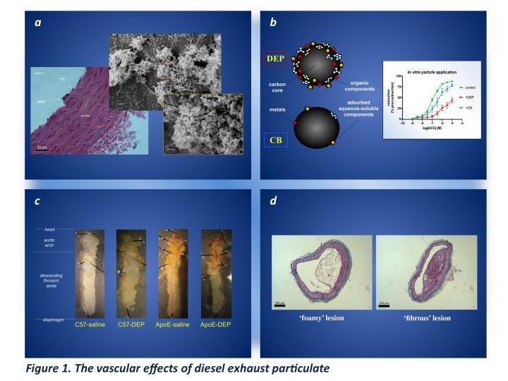 Combination of 4 images outlining the affects and lesions resulting from nanoparticles of air pollution