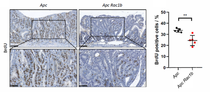 Rac1b deletion effects in a mouse colorectal cancer model. 