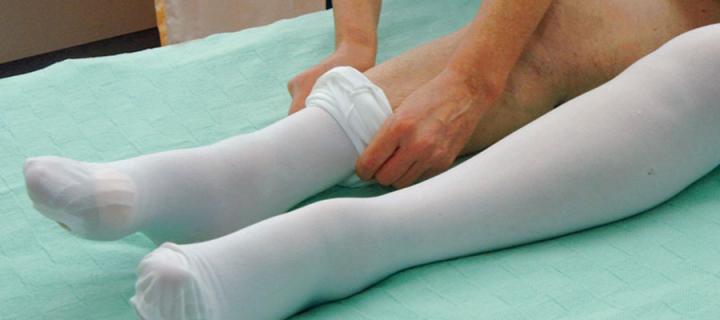 Photo of a nurse putting compression stockings on a patient