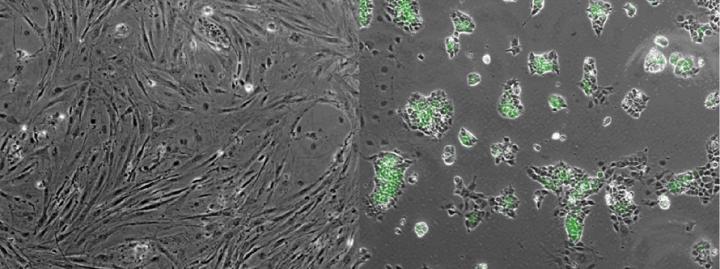 Induced pluripotent stem cells