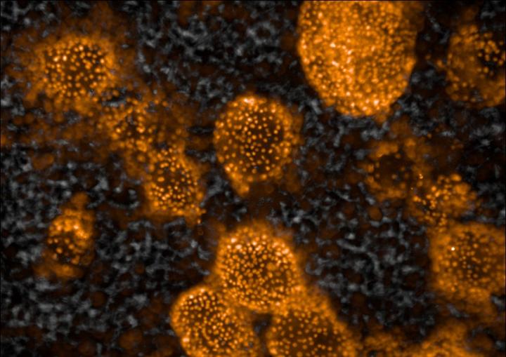 Spheres of stem cell-derived liver cells (orange) placed on the scaffold. 