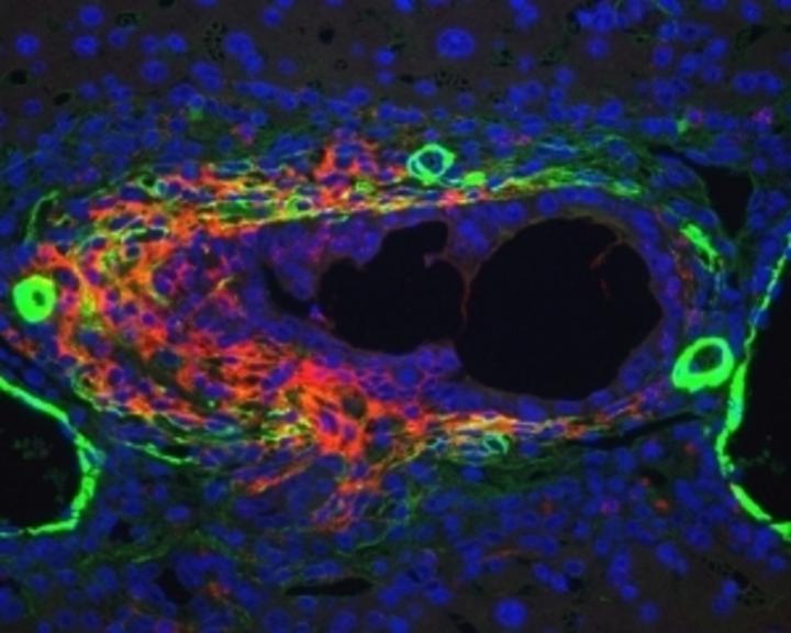 liver progenitor cells
