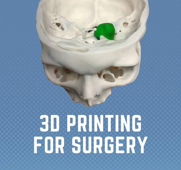 Example 3D Print