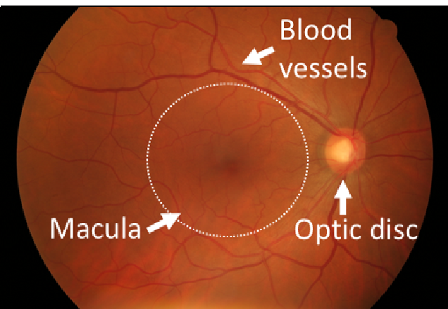 scone retina