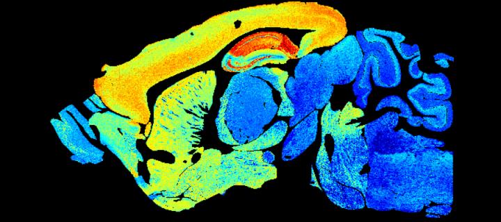 synapse map of mouse brain
