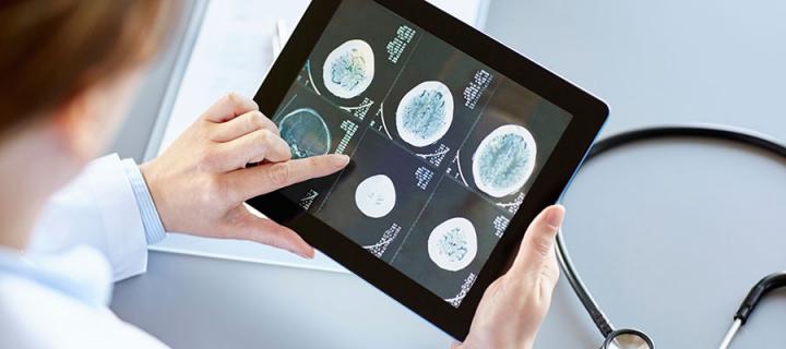 Photo of a doctor looking at a brain scan on a tablet computer