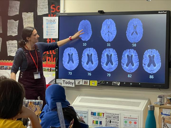 Dr. Muñoz Maniega teaching children about MRI in a busy classroom. She is pointing at a screen with images of the brain.