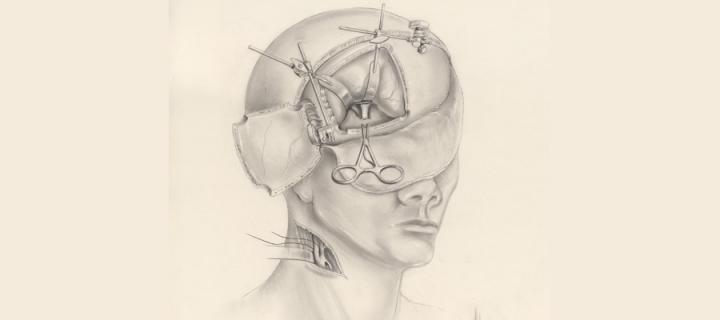 Pencil anatomy drawing of the head