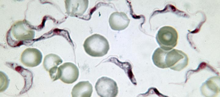 Blood film with trypanosomes