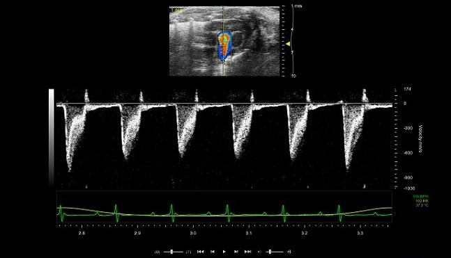 Figure 2: Spectral Doppler (bottom) and colour Doppler showing measurement of blood flow in adult mouse pulmonary artery.