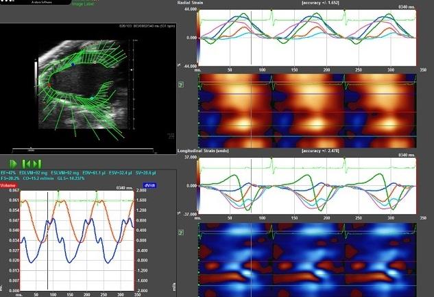 Figure 3: Analysis screen showing radial and longitudinal strain at five points on murine left ventricular endocardial wall 
