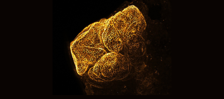 A dividing liver cyst stained with E-cadherin and imaged with 3D whole mount imaging