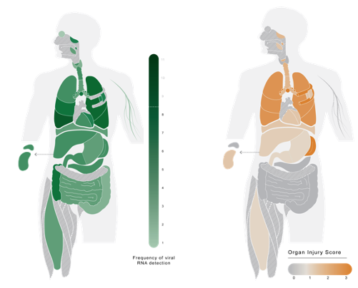Image showing viral presence in many organs compared to inflammation, which is mostly limited to the lungs.