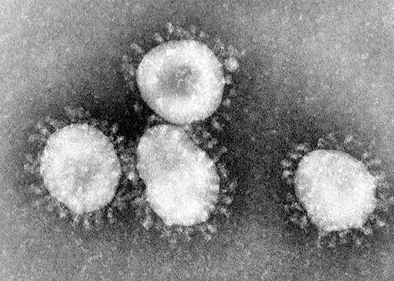 An electron micrograph of a coronavirus particle, showing the distinctive protein spikes.